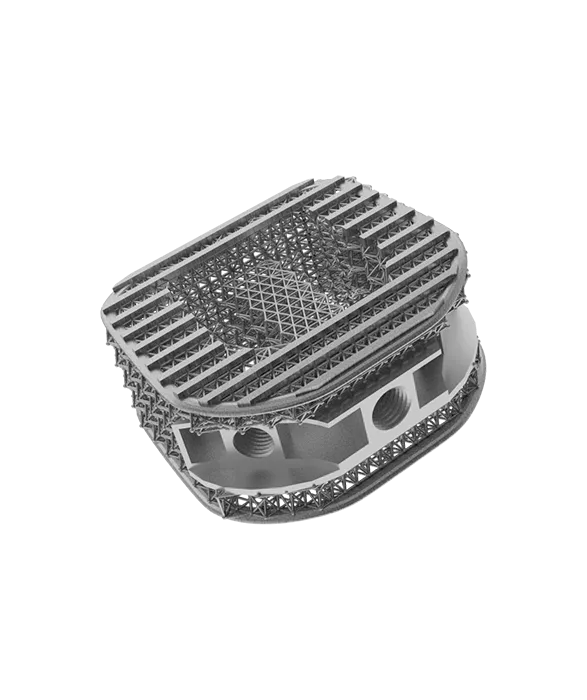 Additive Manufacturing - Medical Spinal Cage