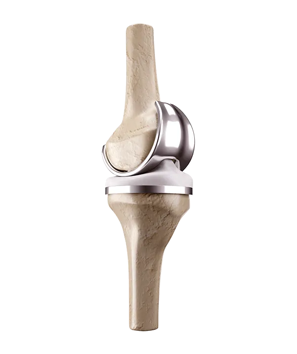 Additive Manufacturing - Medical Orthopedic Devices